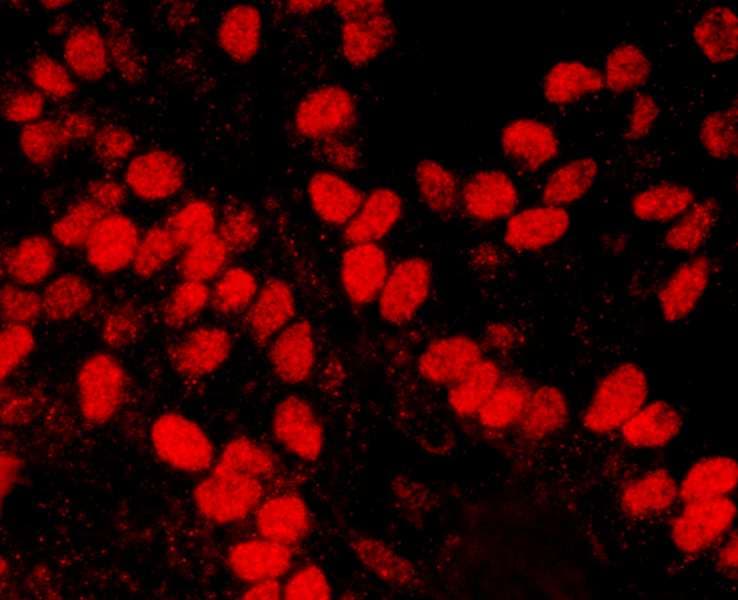 Polyclonal Rabbit anti-Human HMGN1 / HMG14 Antibody (aa90-100, IHC, IF, WB)