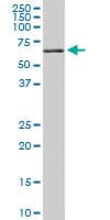 Monoclonal Mouse anti-Human RICK / RIP2 Antibody (clone 3D9, WB)