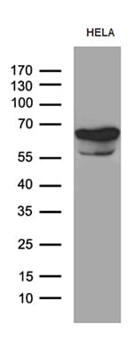 TGFBI Antibody (aa405-683, clone OTI9A11)
