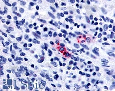 IHC-plus™ P2Y13 / P2RY13 Antibody (Extracellular Domain)