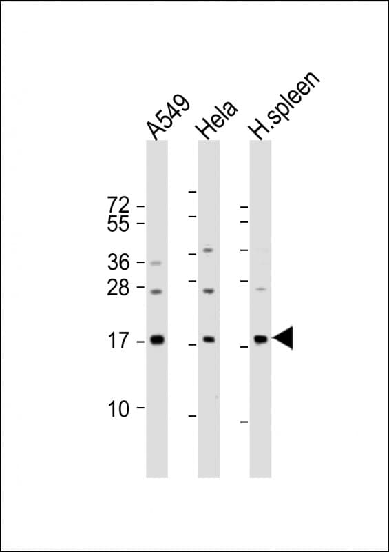 Polyclonal Rabbit anti-Human PLA2G2A / SPLA2 Antibody (aa106-135, WB)