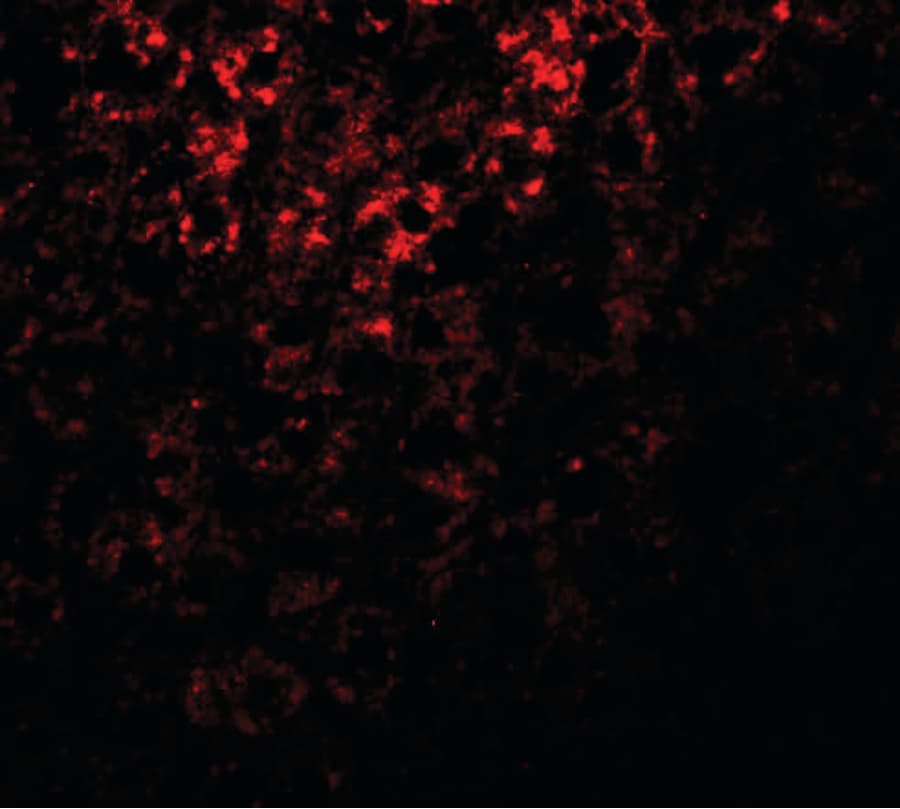 Polyclonal Rabbit anti-Human ATG101 Antibody (IHC, IF, WB)