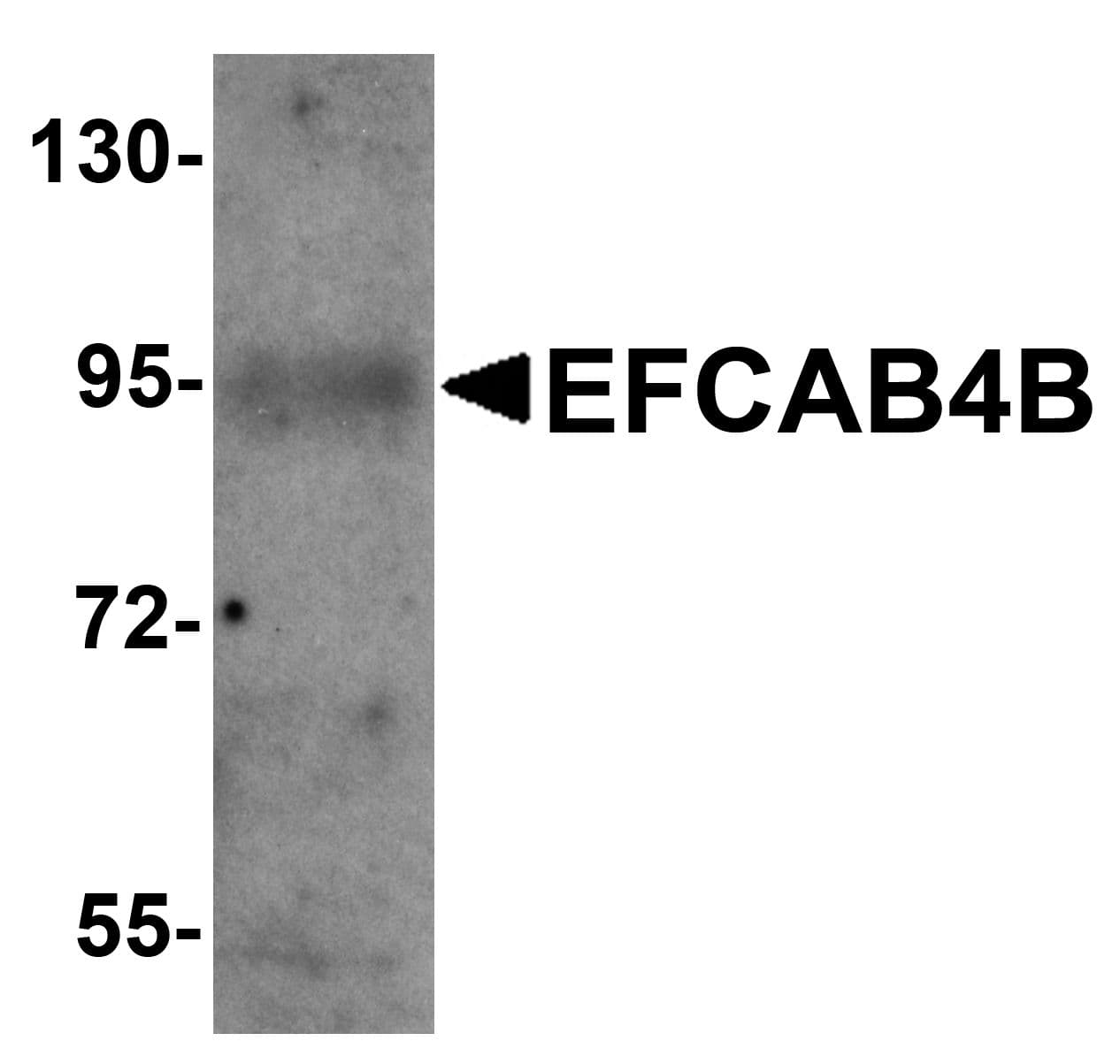 IHC-plus™ CRACR2A / EFCAB4B Antibody