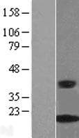 CRABP2 Protein (Over-Expression Lysate Myc-DDK (Flag))