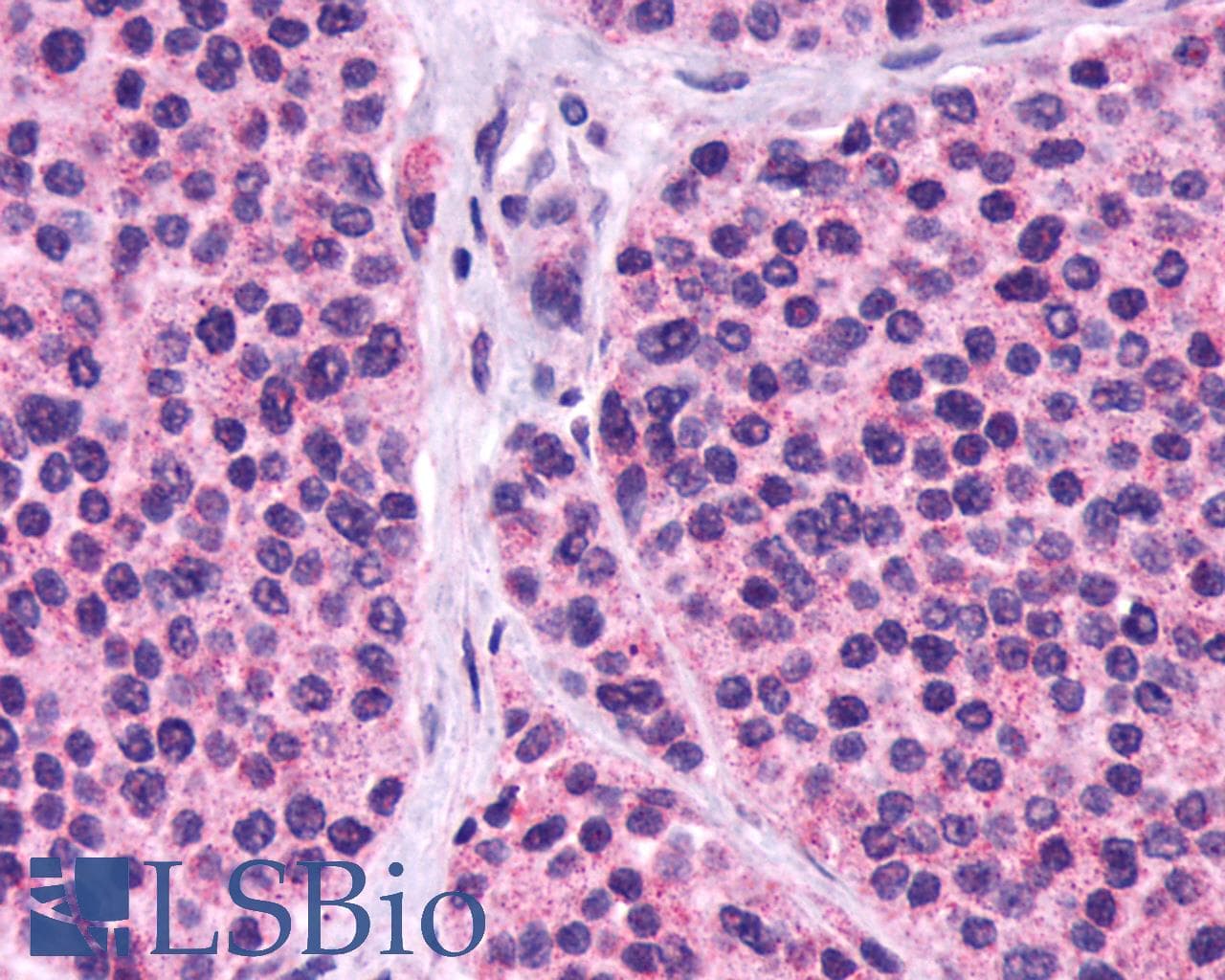 PathPlus™ CASR/Calcium Sensing Receptor Antibody (N-Terminus)