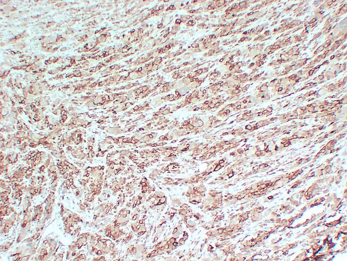PMEL / SILV / gp100 Antibody (clone ABT-PMEL)
