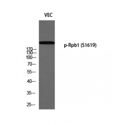 POLR2A / RNA polymerase II Antibody (1560-1640 aa)