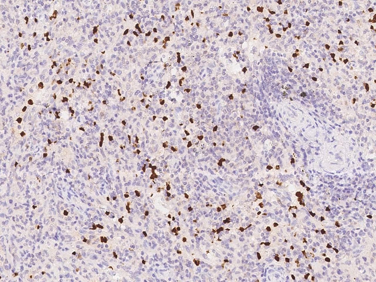 Polyclonal Rabbit anti-Human OTOA Antibody (IHC)