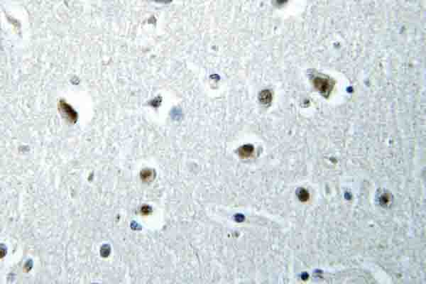 POLR2E Antibody (Leu58)
