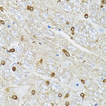 TPPP Antibody