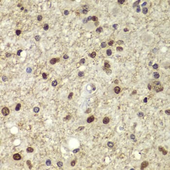 POU5F1 / OCT4 Antibody