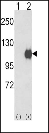 Polyclonal Rabbit anti-Human ENPP2 / Autotaxin Antibody (aa377-406, WB)