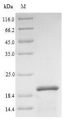 Alnus glutinosa Major pollen allergen Aln g 1 Protein (Recombinant 6His, N-terminus)