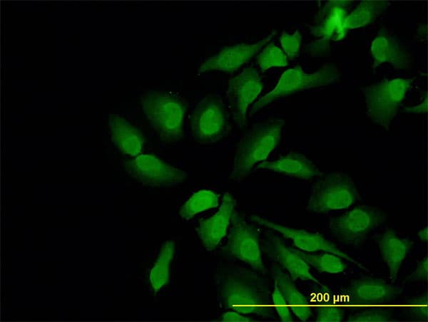 WASL / N-WASP Antibody (clone 5F4)