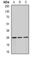 C4BPB / C4BP Beta Antibody