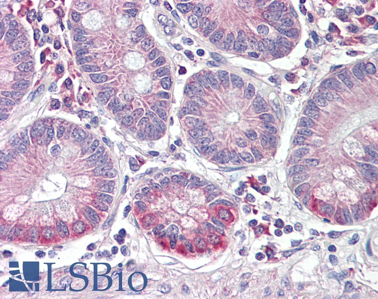 IHC-plus™ Polyclonal Goat anti-Human SLC10A2 / ASBT Antibody (aa337-348, IHC)