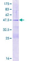 Human NDUFB7 / B18 Protein (Recombinant GST)