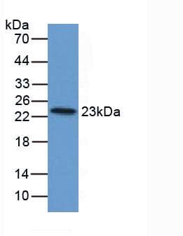 FTL / Ferritin Light Chain Antibody (aa1-175, PE)
