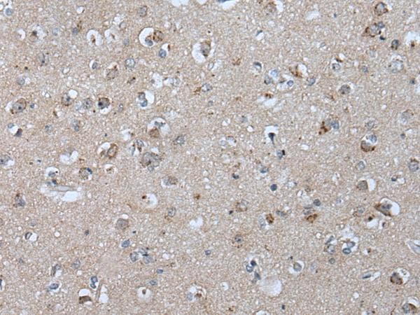 Polyclonal Rabbit anti-Human VPS35 Antibody (IHC, WB)