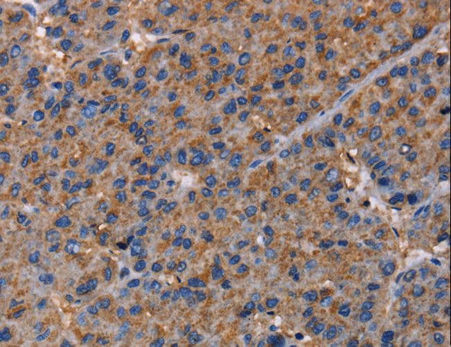NUP62 Antibody