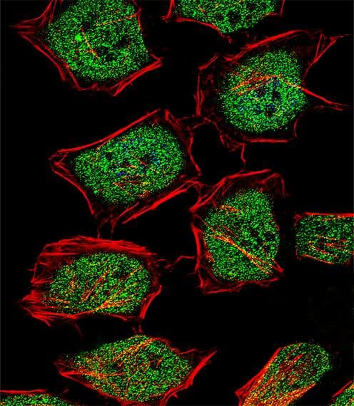Polyclonal Rabbit anti-Human NR3C1/Glucocorticoid Receptor Antibody (aa236-262, IHC, IF, WB)