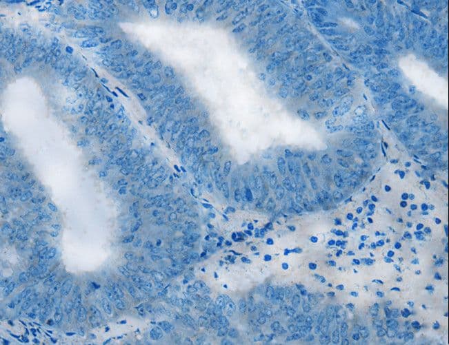 NDUFA9 Antibody