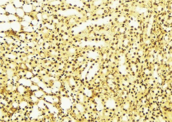Polyclonal Rabbit anti-Human STK17B / DRAK2 Antibody (IHC, WB)
