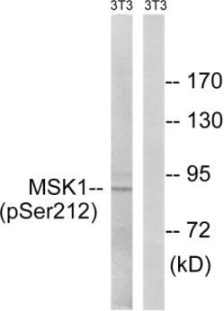 RPS6KA5 / MSK1 Antibody (phospho-Ser212)