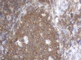 PAI-RBP1 / SERBP1 Antibody (clone OTI4G2)