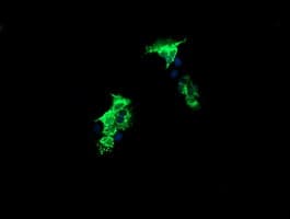 CMPK / CMPK1 Antibody (clone OTI1H8)