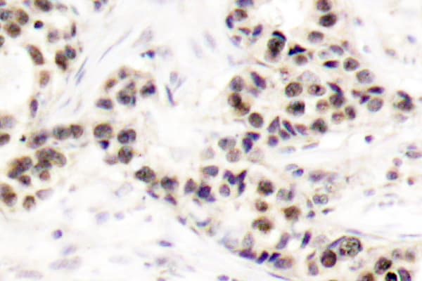 Polyclonal Rabbit anti-Human CHEK2 / CHK2 Antibody (Ser62, IHC, WB)