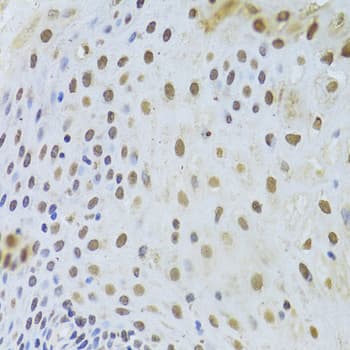 KRT8 / CK8 / Cytokeratin 8 Antibody