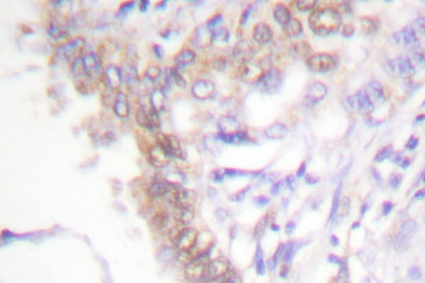 PIAS3 Antibody (Phe25)