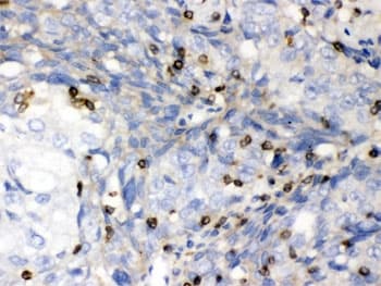 ABL2 Antibody