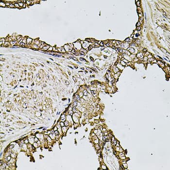 CSTB / Cystatin B / Stefin B Antibody