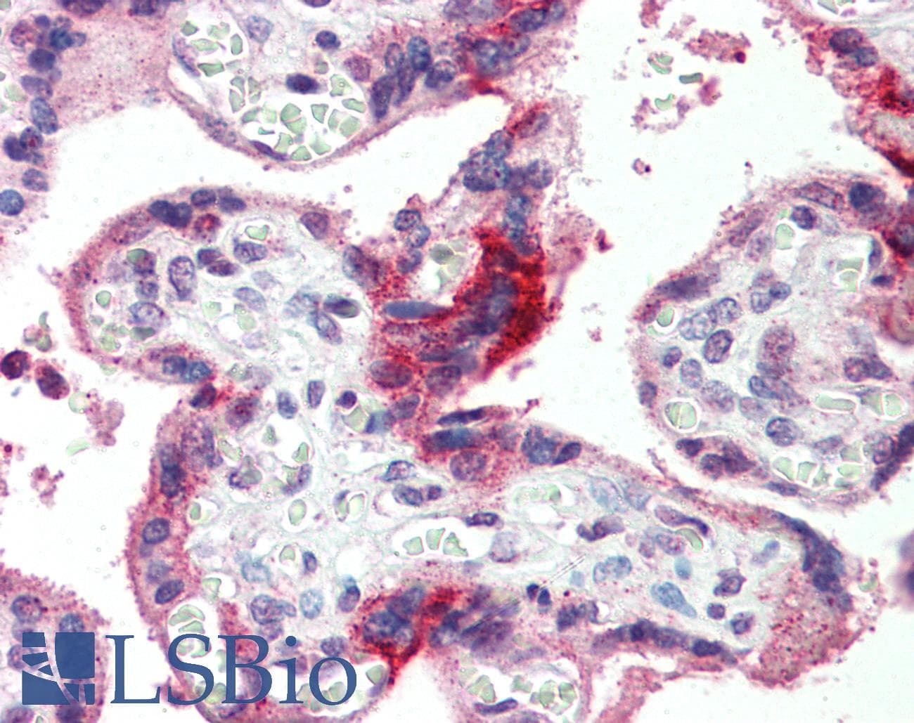 GPSM2 / LGN Antibody (aa72-121)
