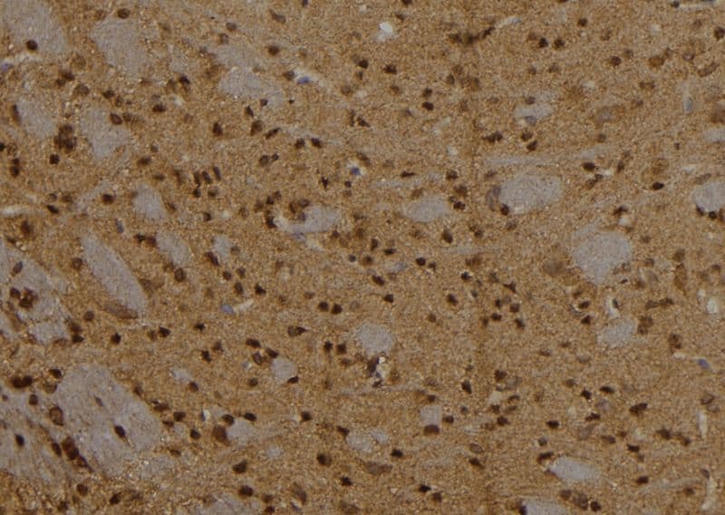 CPXCR1 / CT77 Antibody