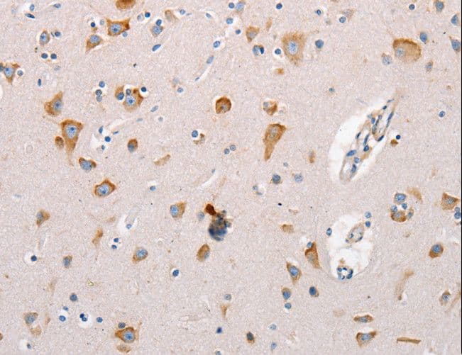 Polyclonal Rabbit anti-Human MTOR Antibody (IHC)