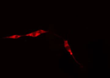 DDX3 / DDX3X Antibody