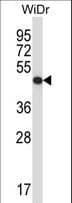 IHC-plus™ QCR2 / UQCRC2 Antibody (aa235-264)