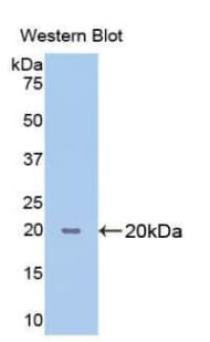 PPIB / Cyclophilin B Antibody (aa47-216)