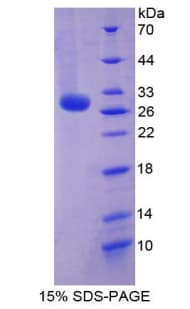 Human RELN / Reelin Protein (Recombinant 6His, N-terminus)