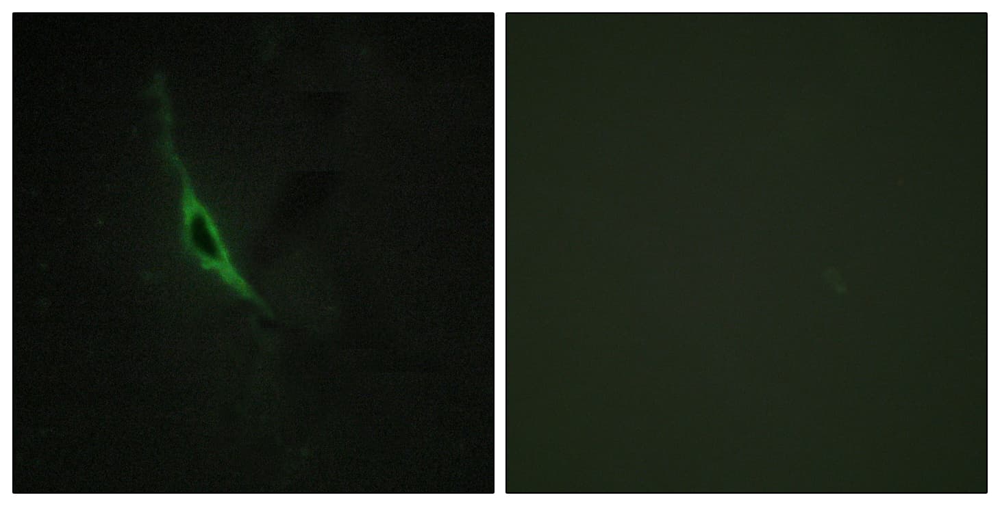 GZMK / Granzyme K Antibody (aa61-110)