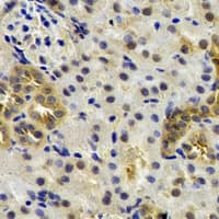 ST3GAL4 / ST3Gal IV Antibody