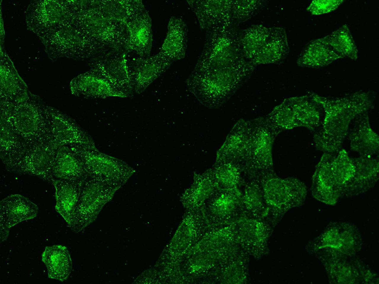 CCT3 Antibody