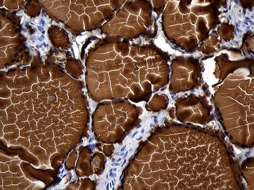 TG / Thyroglobulin Antibody (aa20-358, clone OTI8E1)