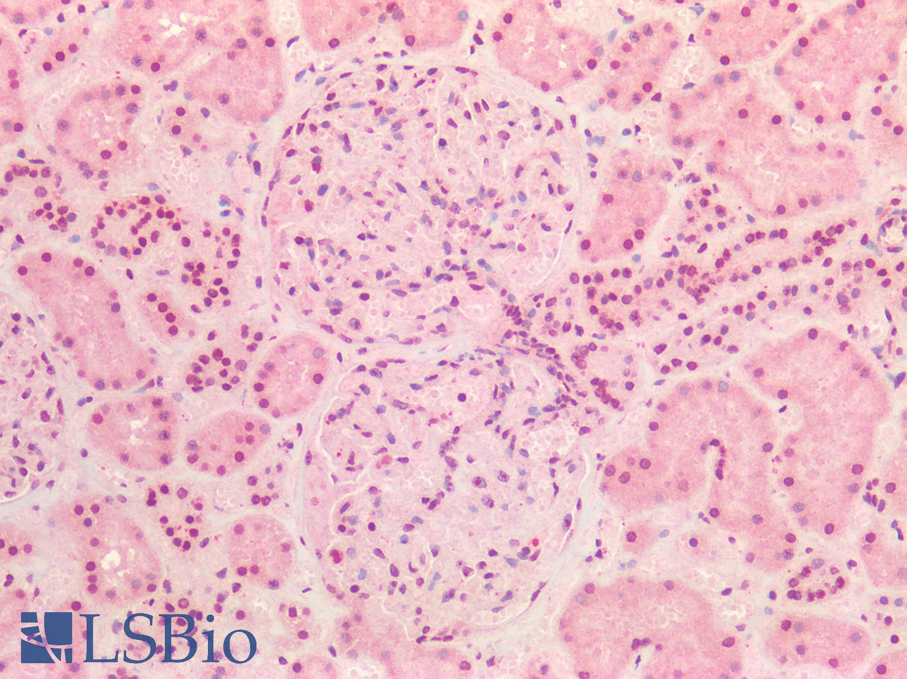 IHC-plus™ Polyclonal Rabbit anti-Human TP53 / p53 Antibody (IHC)