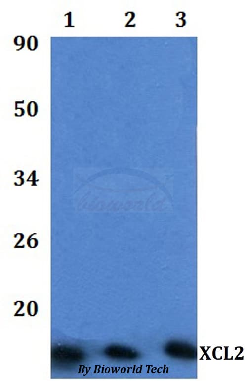 Polyclonal Rabbit anti-Human XCL2 Antibody (WB)