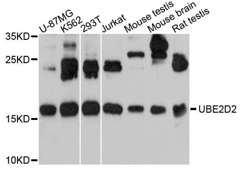 Polyclonal Rabbit anti-Human UBE2D2 / UBCH5B Antibody (WB)