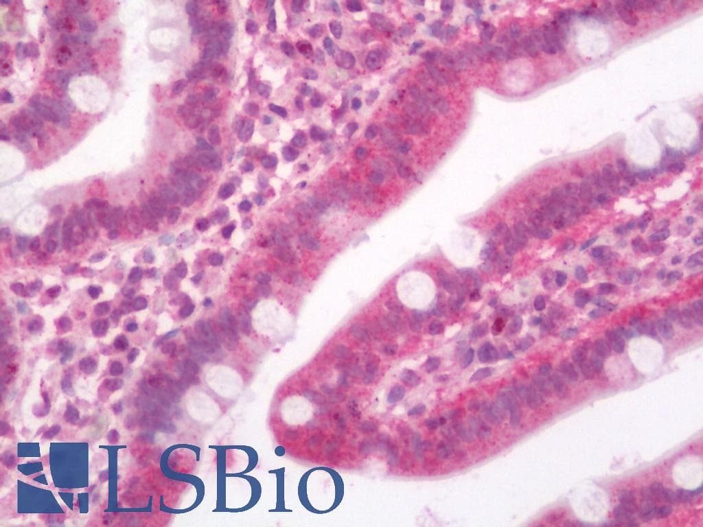 IHC-plus™ Polyclonal Rabbit anti-Human SLC29A1 / ENT1 Antibody (IHC, IF, WB)